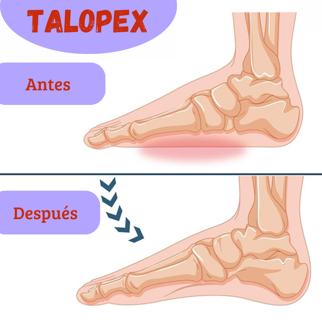 TaloPex - Taloneras Ortopedicas